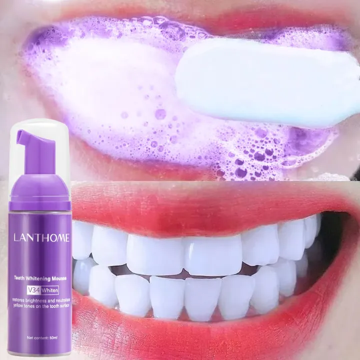 Lanthome V34 teeth whitening and stain remover mousse Colour Corrector restores brightness and neutralises yellow tones on the tooth surface
