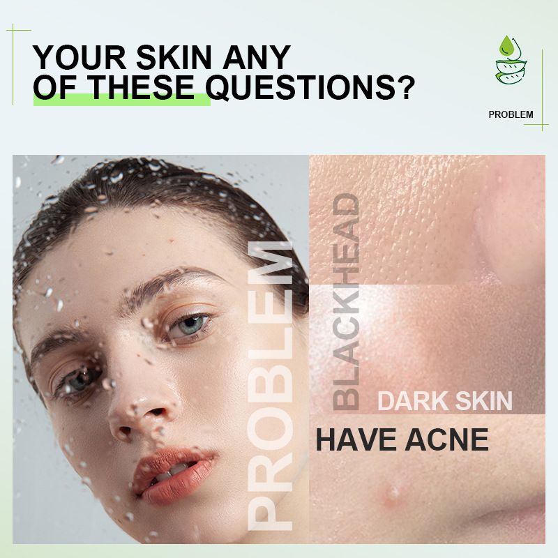 KORMESIC Natural aloe vera firming gel after sun repairing moisturising soothing anti-inflamatory