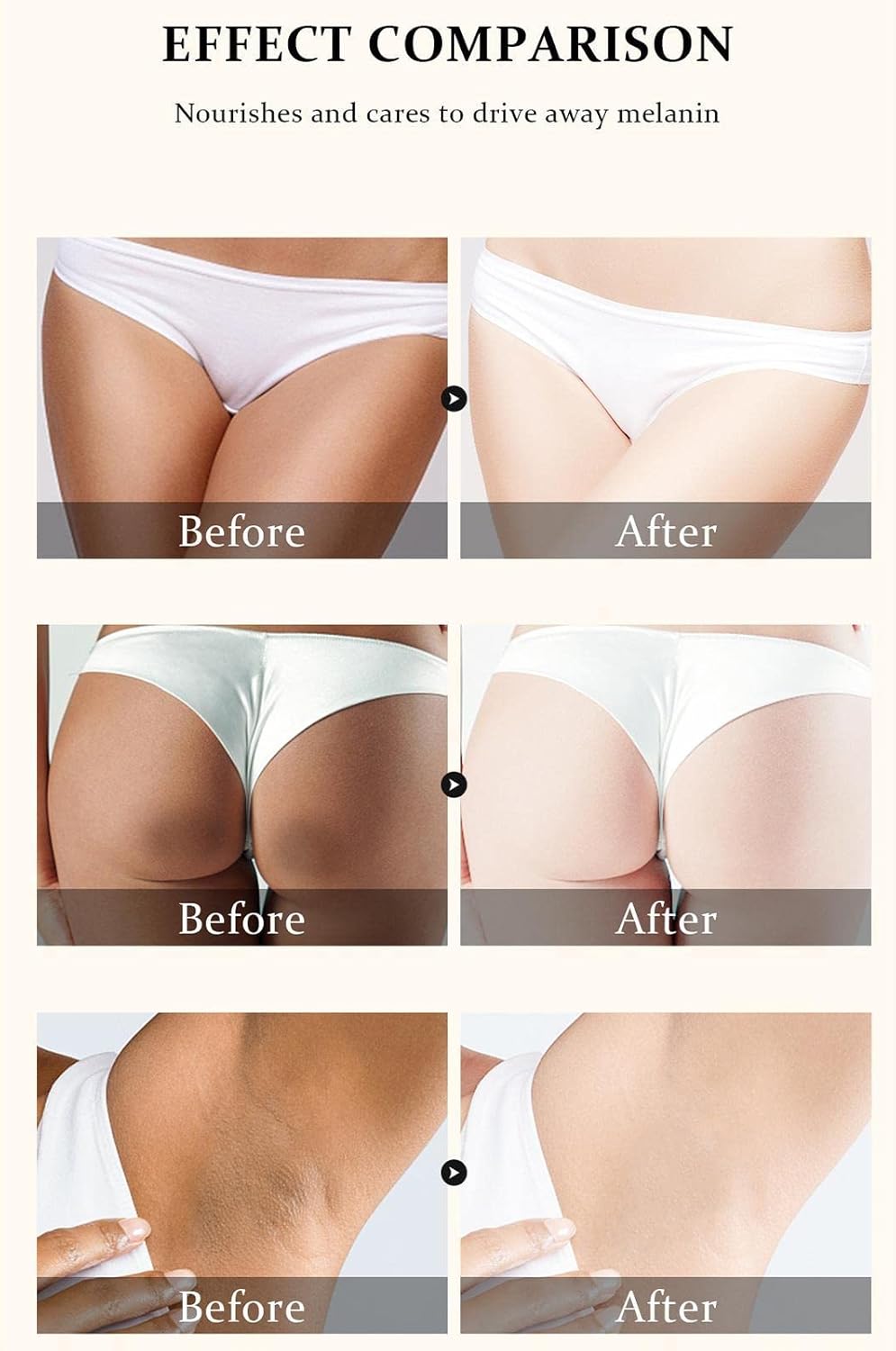 Whitening Cream for Intimate Area, Bleaching Cream for the Intimate Area for Women - 60 g Skin Bleach for Sensitive Areas in Women, Dark Inner Thighs and Intimate Area Pologmase