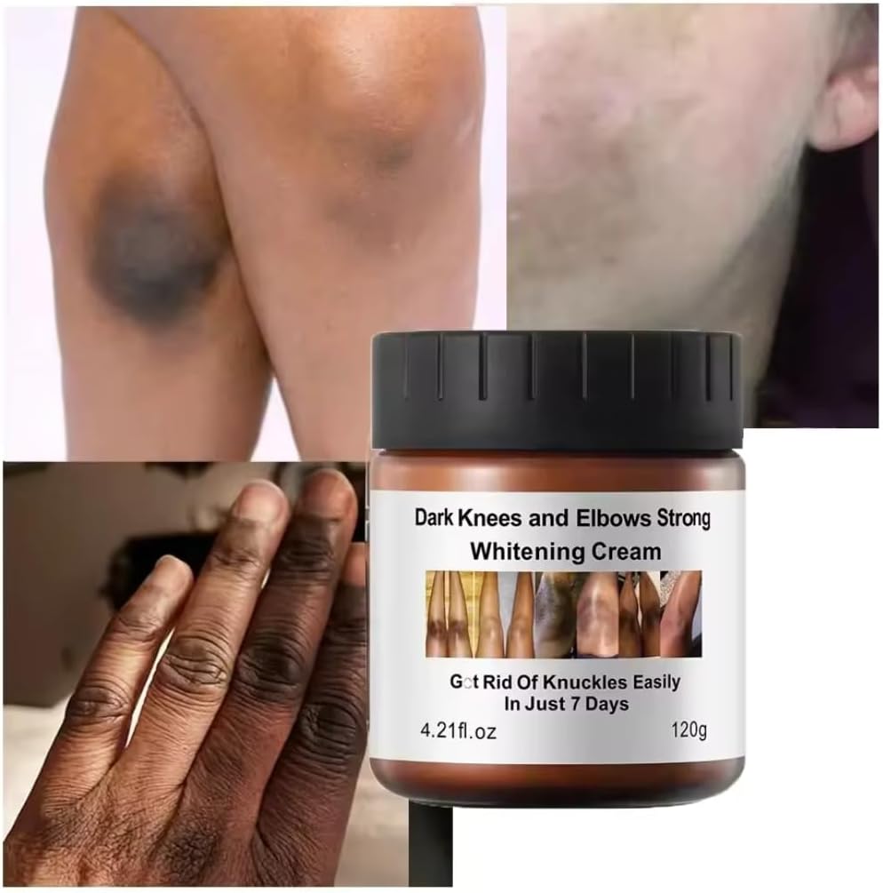 Dark Knees & Elbows Whitening Cream 120G, Underarm Dark Armpit Dark Spot Brightening Whitening Cream, Whiten Dark Knuckles, Strong Skin Whitening for Women & Men, Nourish Moisturize Scars