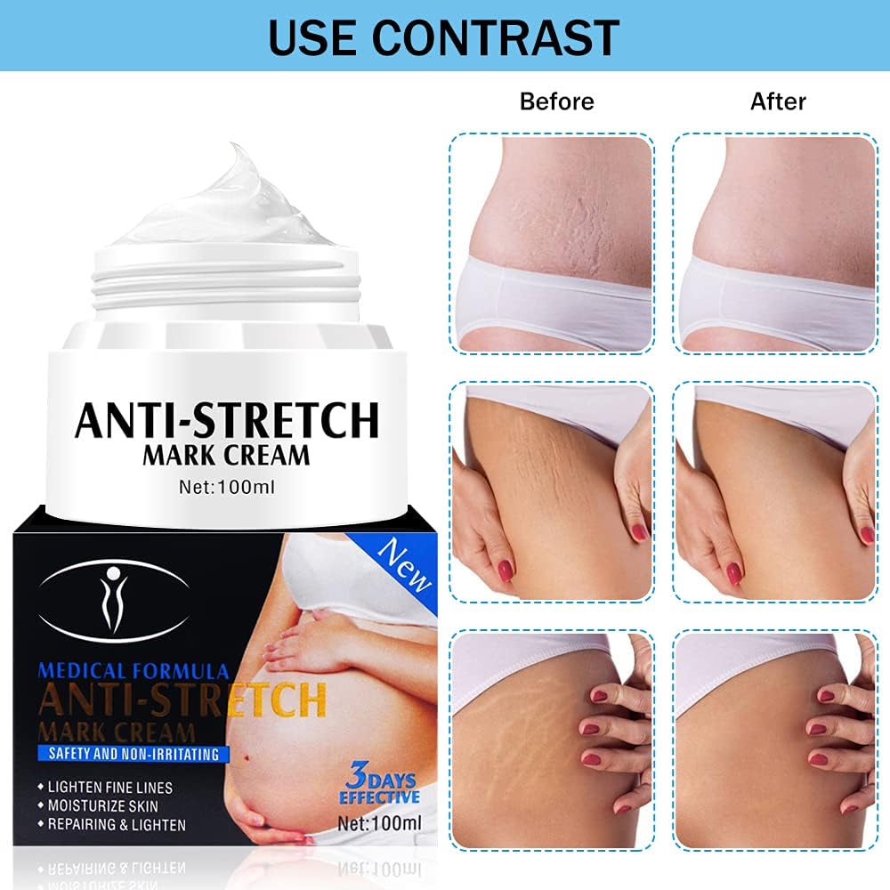 Aichun Beauty Anti-Stretch Mark Cream - Lightens Fine Lines, Moisturizes Skin, Repairing