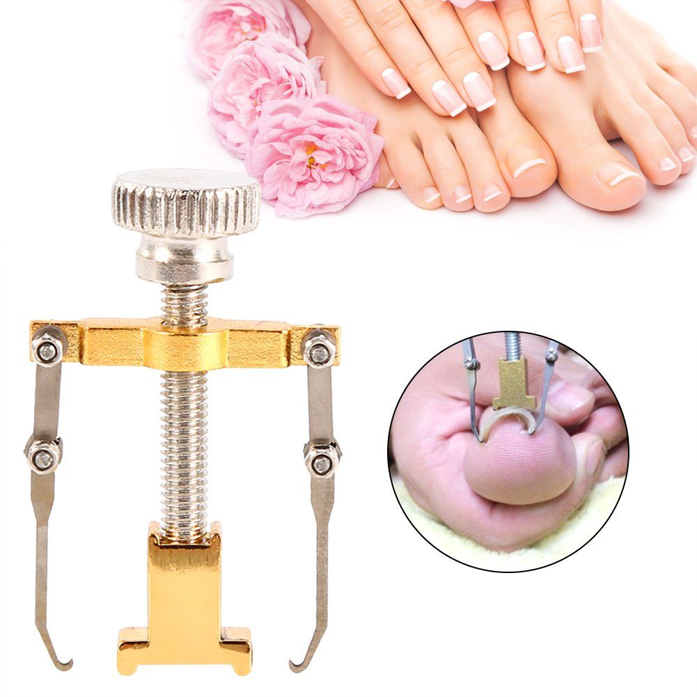 Ingrown Nail Corrector,Professional Ingrown Toe Nail Correction Kit Pedicure Toes Treatment Tools Set for Paronychia (Ingrown Nail Corrector)
