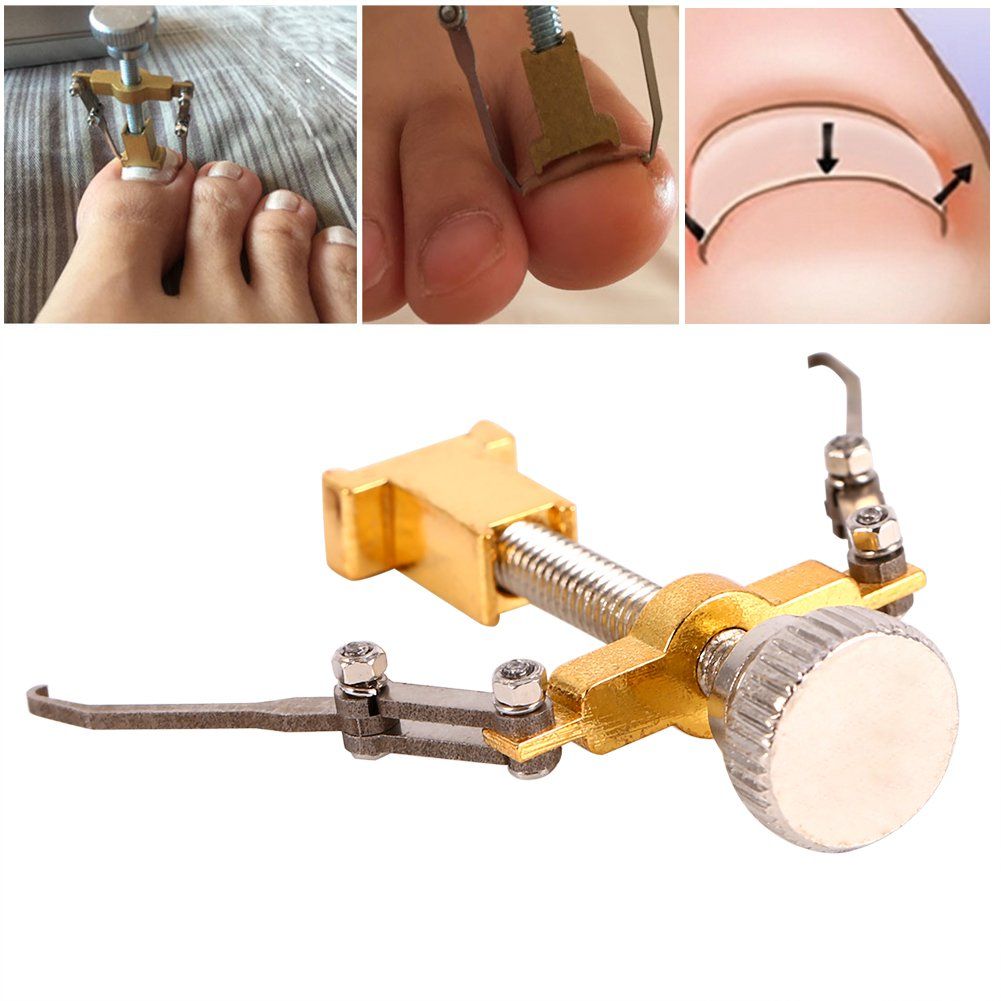 Ingrown Nail Corrector,Professional Ingrown Toe Nail Correction Kit Pedicure Toes Treatment Tools Set for Paronychia (Ingrown Nail Corrector)