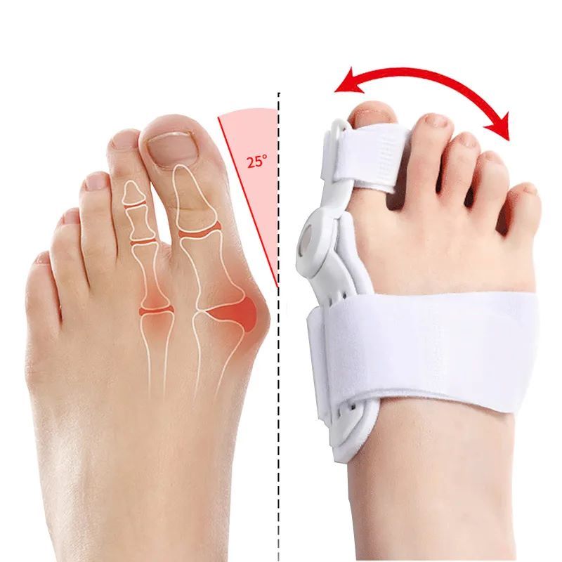 2Pcs Bunion Corrector For Women And Men Big Toe Relief Adjustable Splint Pads Orthopedic Straightener Separator Bunion Corrector Foot Health