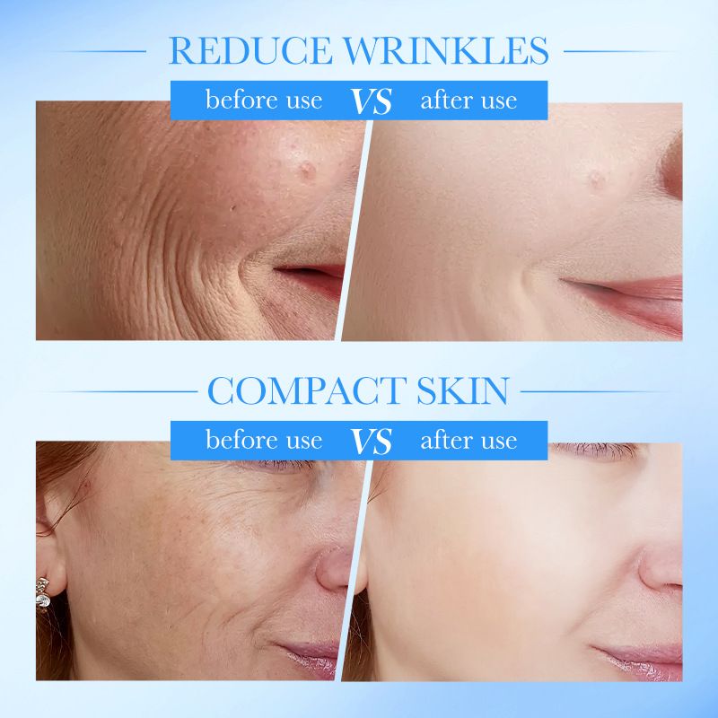 Collagen Moisturizing Anti-Wrinkle Cream – Hydrating, Skin-Softening, and Firming Face Cream