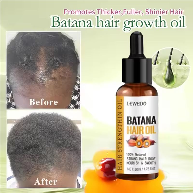 Batana Hair Mask Batana Hair Growth Oil Scalp Hair Strengthening Essential Oils Nourishing Damaged Hair Growth Care