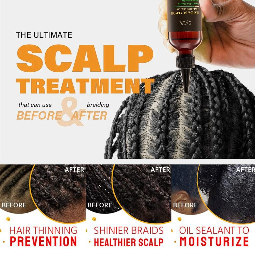 200ml Natural Castor Oil Hair & Scalp Treatment Oil Nourishing Hair Growth Massage Oil Plant Extract Hair Care Oil for Dry Hair Moisturizing Smooth Hair Serum for Men Women