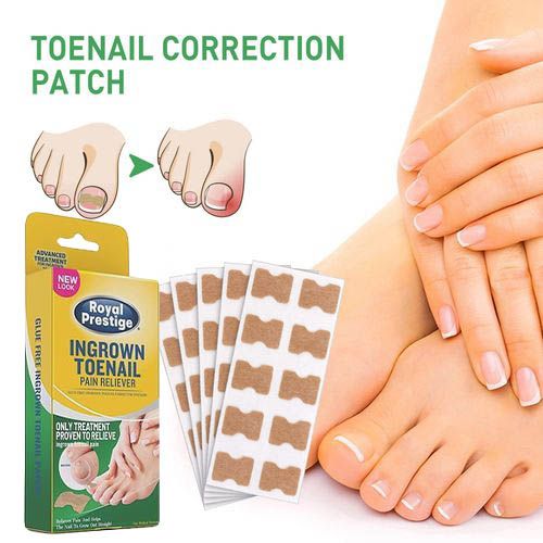 50pcs/Box Royal Prestige Ingrown Toenail Sticker Toenail Correction Patch Tools Kit Nail Foot Tool Toe Nail Fingernail Care Tool
