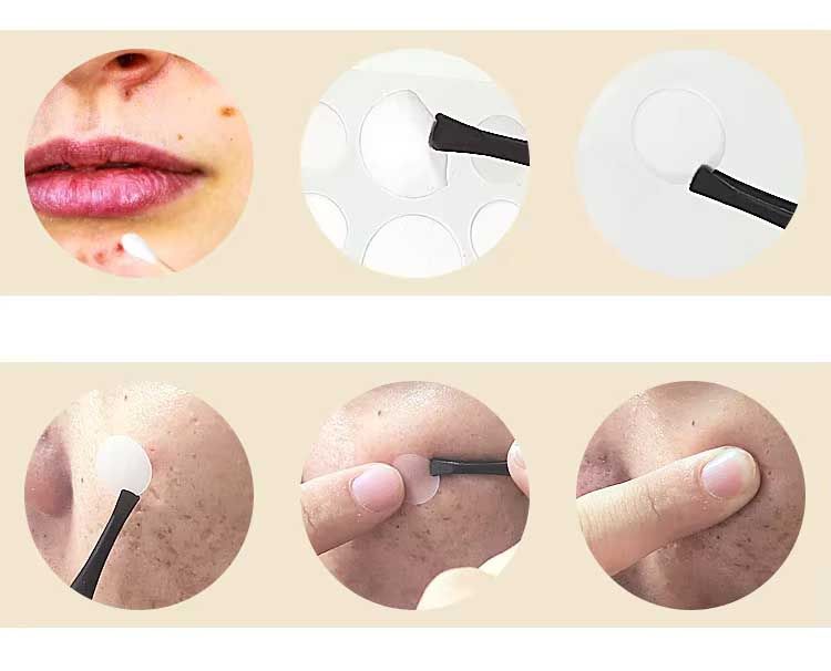 Pimple Patches, 36 Spot Patches, Hydrocolloid Patches, Invisible Acne Stickers for Skin Treatment (8mm, 10mm, 12mm)