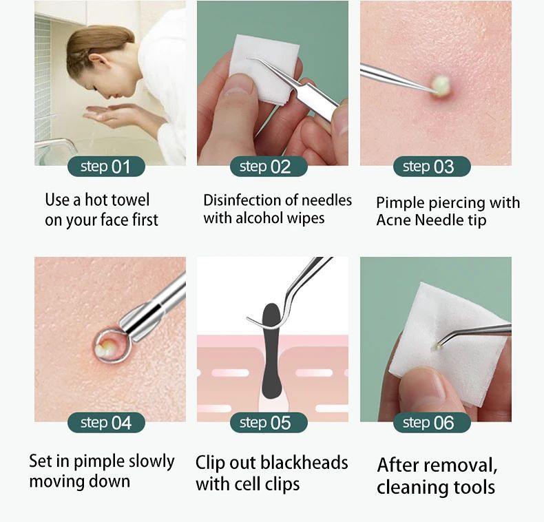 11pcs Acne Blackhead Removal Needles Stainless Steel Black Spot Blemish Pimple Removal Needle Deep Cleansing Tool Face Skin Care Kit