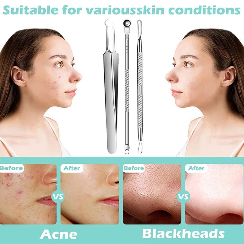 11pcs Acne Blackhead Removal Needles Stainless Steel Black Spot Blemish Pimple Removal Needle Deep Cleansing Tool Face Skin Care Kit