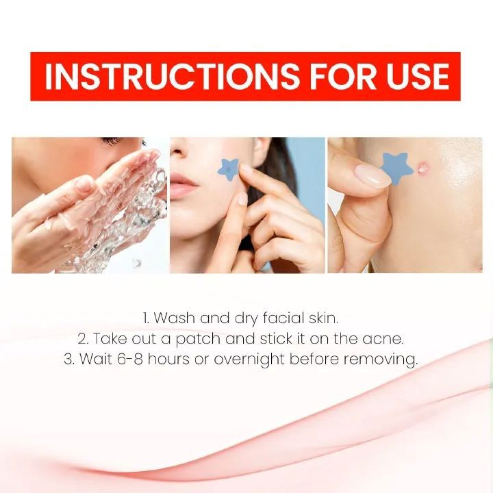 200pcs Pimple Patch Repair Acne Patch Facial Skin Care Fade Blemishes Pimple Marks Closed Acne Blemishes Cover Acne Pimple Repair Patch Acne Treatment Devices