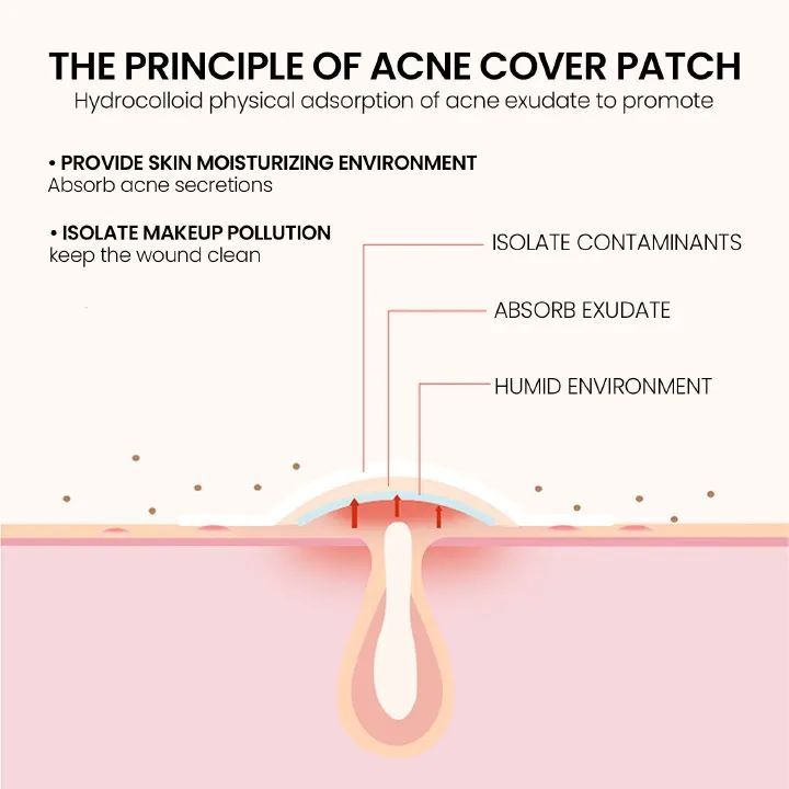 200pcs Pimple Patch Repair Acne Patch Facial Skin Care Fade Blemishes Pimple Marks Closed Acne Blemishes Cover Acne Pimple Repair Patch Acne Treatment Devices