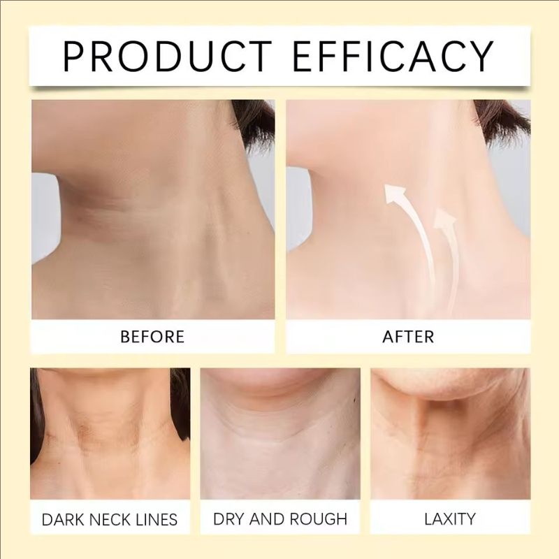 Bee-Venom Neck Care Stick Contains Collagen Lift & Tighten Skin Lighten Neck Lines Double Chin Moisturizing Beauty Neck Cream