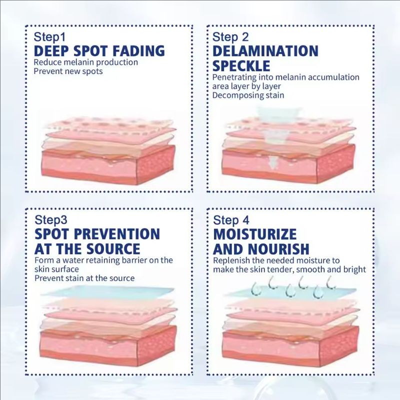 Whit-ening Face Serum Remove Dark Sp-ots F-reckle Essence Anti-Aging Niacinamide Fade Pigme-ntation Melas-ma Brighten Skin Care