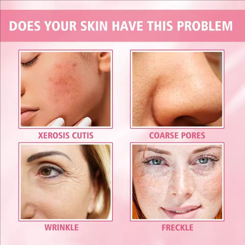 Melasma Remover Serum Whitening Black Dots Anti Brown Stain Spots Lightening Melanin Pigmentation Freckle Correction Essence