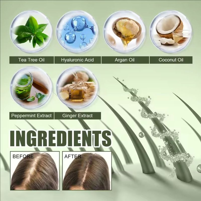 Fast Hair Growth Oil Africa Crazy Traction Alopecia Serum Anti Hair Break Thicken Hair Loss Treatment Spray Beauty Health