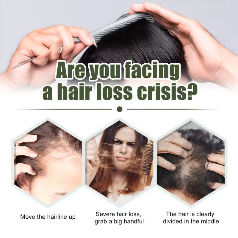 Fast Hair Growth Oil Africa Crazy Traction Alopecia Serum Anti Hair Break Thicken Hair Loss Treatment Spray Beauty Health