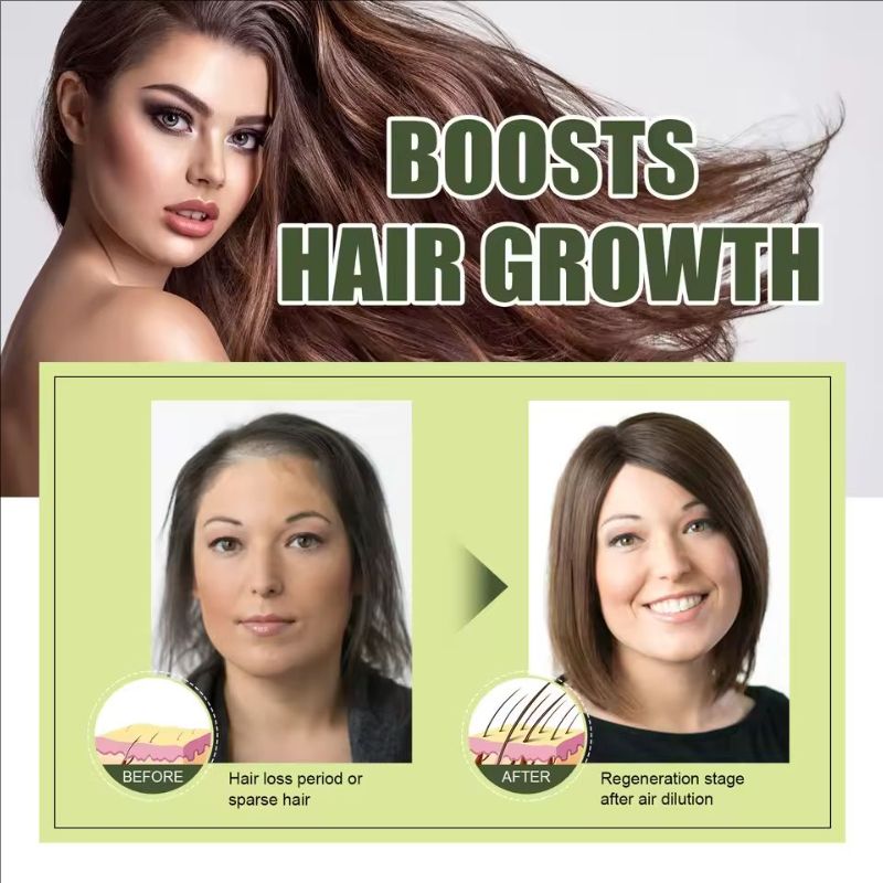 Fast Hair Growth Oil Africa Crazy Traction Alopecia Serum Anti Hair Break Thicken Hair Loss Treatment Spray Beauty Health