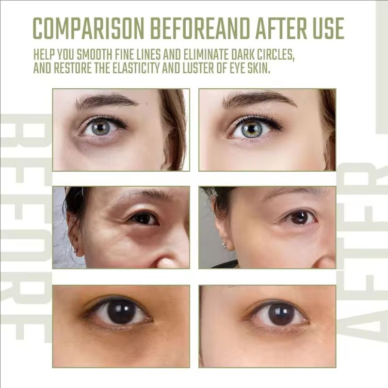 Instant Eye Bag Remover Niacinamide Anti-wrinkle Lightens Fine Lines Firms Skin Lightens Dark Circles Brightens Eye Care