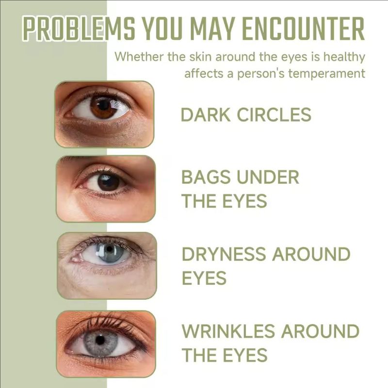 Instant Eye Bag Remover Niacinamide Anti-wrinkle Lightens Fine Lines Firms Skin Lightens Dark Circles Brightens Eye Care