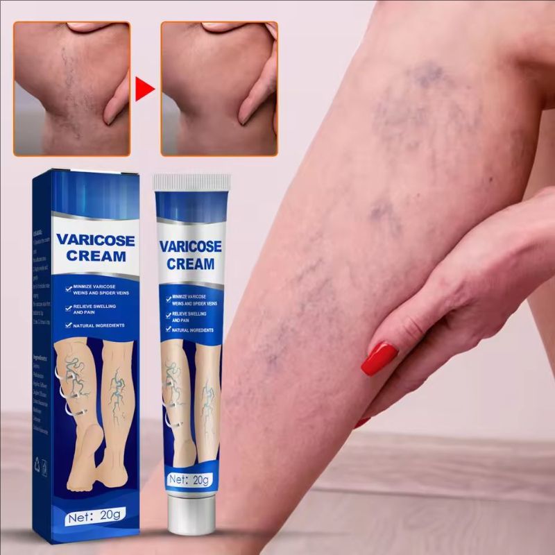 Venoheal Varicose Vein Ease Paste Varicose Veins Paste Varicose And Spider Veins Ease For Legs Improve Blood Circulatio