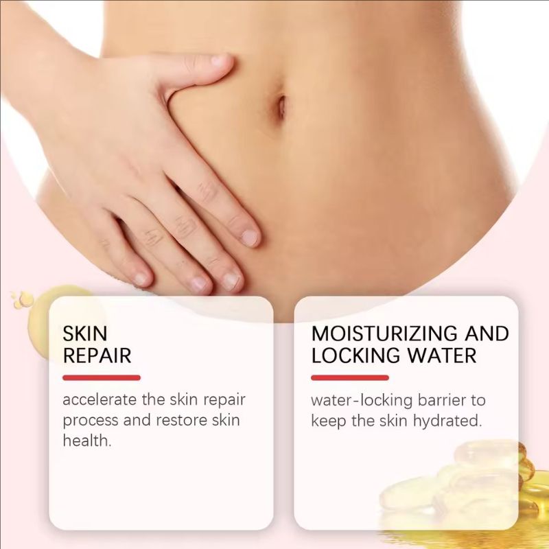 Stretch Mark Removal Cream Pregnancy Women Repairing Postpartum Obesity Firming Body Lotion Anti Fine Lines Maternity Skin Care