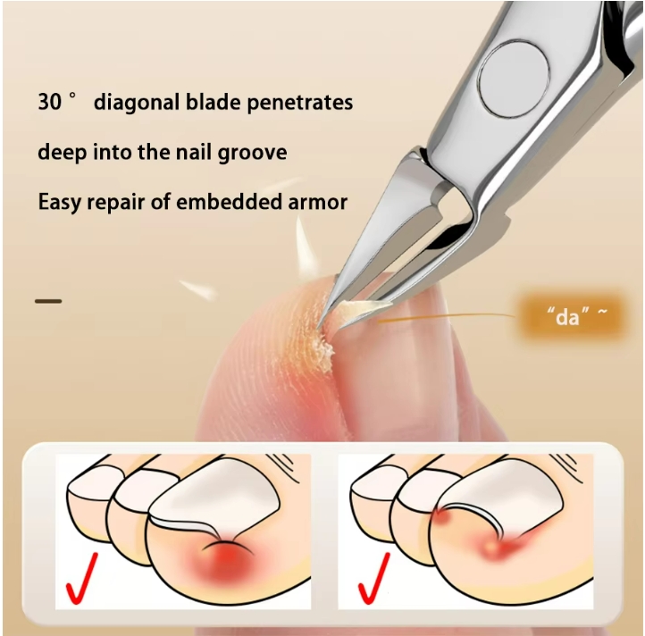 Single Nail Clipper Nail Groove Specialized Nail Clipper Set With Inlaid Nail Clippers Oblique Mouth Foot Repair Tool Eagle
