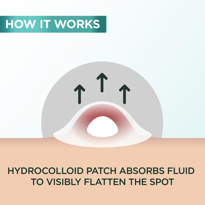 Garnier Pure Active 8hr Invisible Pimple Patch, Enriched with Hydrocolloid that Reduce Pimple Size in 8 hours