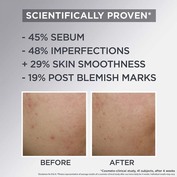 【Discounted】Garnier AHA+BHA Charcoal Mattifying Air Moisturizing Cream