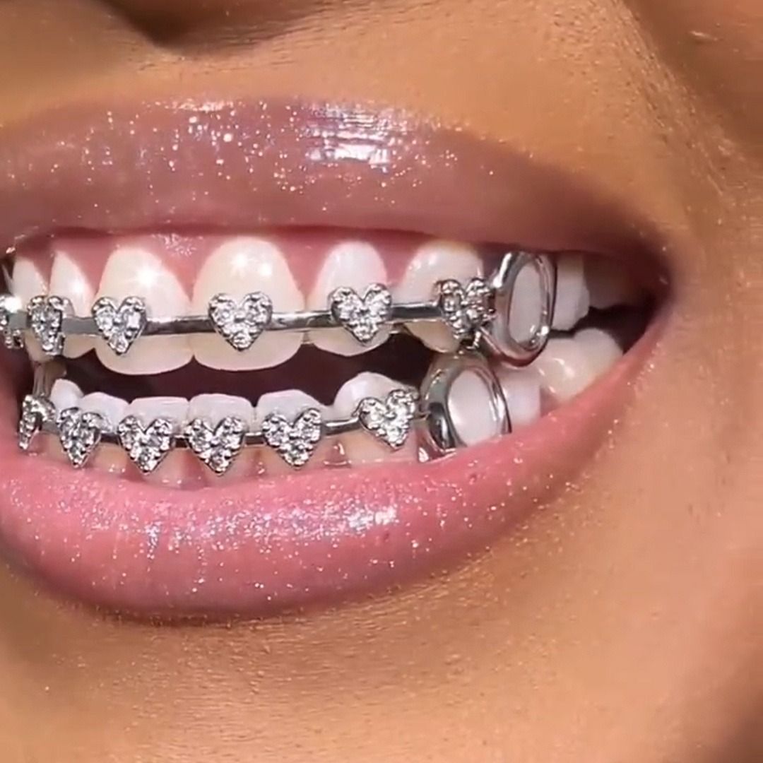 Hip hop braces with real gold electroplating 8-tooth micro inlaid with love and full diamonds cross-border HIPHOP braces Halloween hip-hop accessories