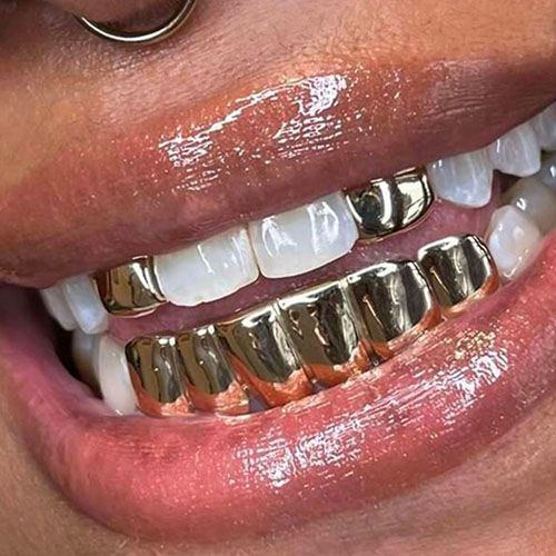 3 pcs teeth grillz jewelry set for man/women hip hop teeth grillz including 2 pcs top single teeth and 1 bottom teeth grillz idea gift jewelry accessories for hip hop lovers