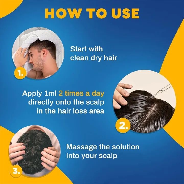 1pcs 5% Minoxidil Tincal Hair Growth Oil Dense Hair Growth Serum Scalp Nutrients