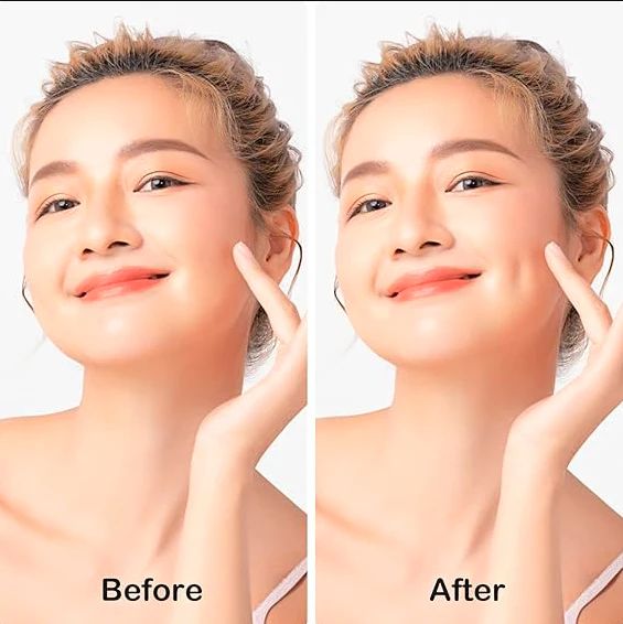 2 pcs Dimple Makers for Cheeks Trainer for Ball, Easy to Wear and Develop Natural Dimples