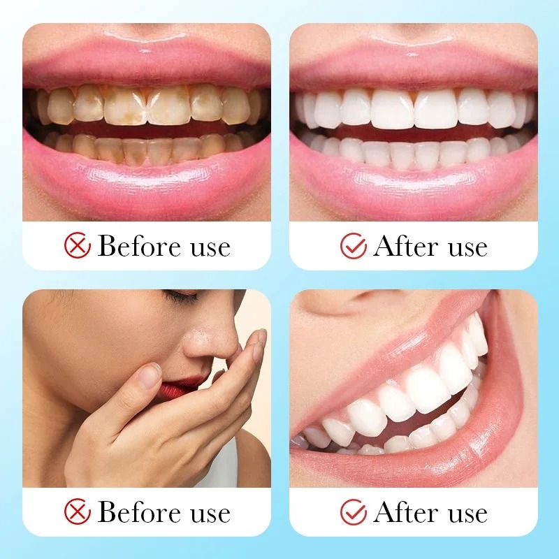 Toothpaste 100g Multi-effect Gum Care Toothpaste Ginger Propolis Mint Flavored Toothpaste To Remove Tooth Stains Smoke Coffee Stains Clean Mouth Keep Fresh Breath Teeth Sensitivity Relief &Cavity