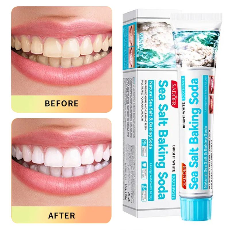 Toothpaste 100g Multi-effect Gum Care Toothpaste Ginger Propolis Mint Flavored Toothpaste To Remove Tooth Stains Smoke Coffee Stains Clean Mouth Keep Fresh Breath Teeth Sensitivity Relief &Cavity