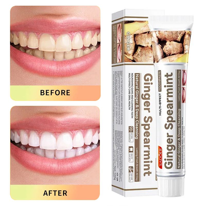 Toothpaste 100g Multi-effect Gum Care Toothpaste Ginger Propolis Mint Flavored Toothpaste To Remove Tooth Stains Smoke Coffee Stains Clean Mouth Keep Fresh Breath Teeth Sensitivity Relief &Cavity
