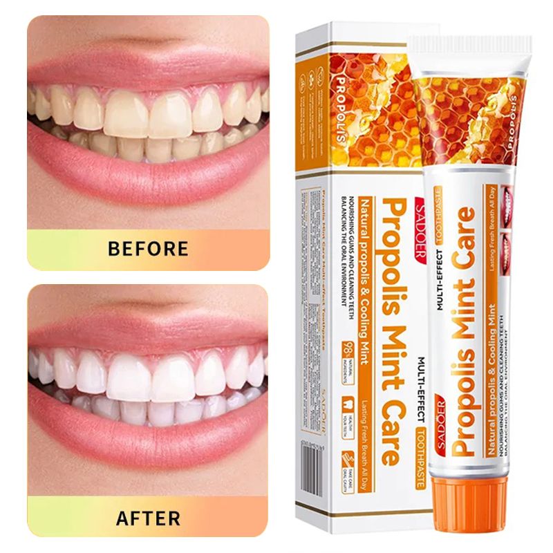 Toothpaste 100g Multi-effect Gum Care Toothpaste Ginger Propolis Mint Flavored Toothpaste To Remove Tooth Stains Smoke Coffee Stains Clean Mouth Keep Fresh Breath Teeth Sensitivity Relief &Cavity