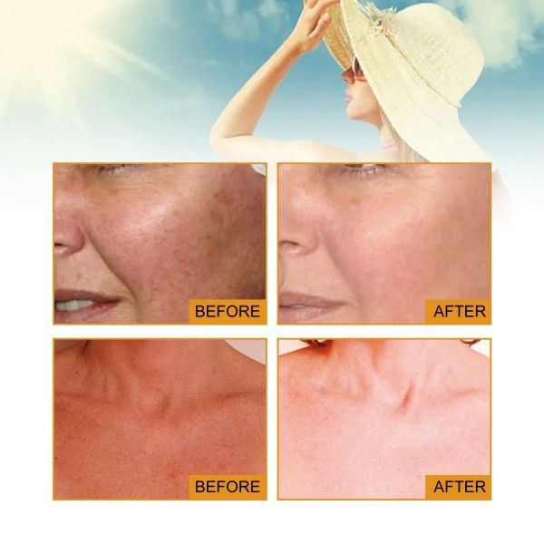Spf50+ Facial Sunscreens  Rapid Film Forming Oil Control Refreshing Anti-Acne Sunscreen