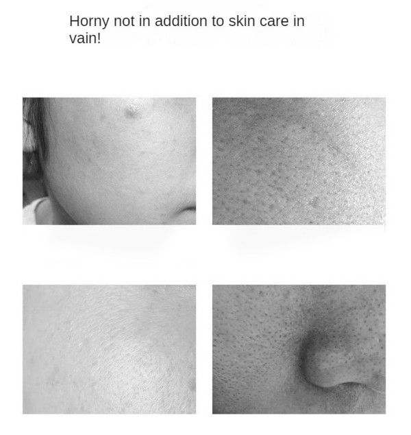 Aloe Vera Exfoliating Gel Deep Cleansing Face Gentle Exfoliating Body ScrubPolishes & Scrubs