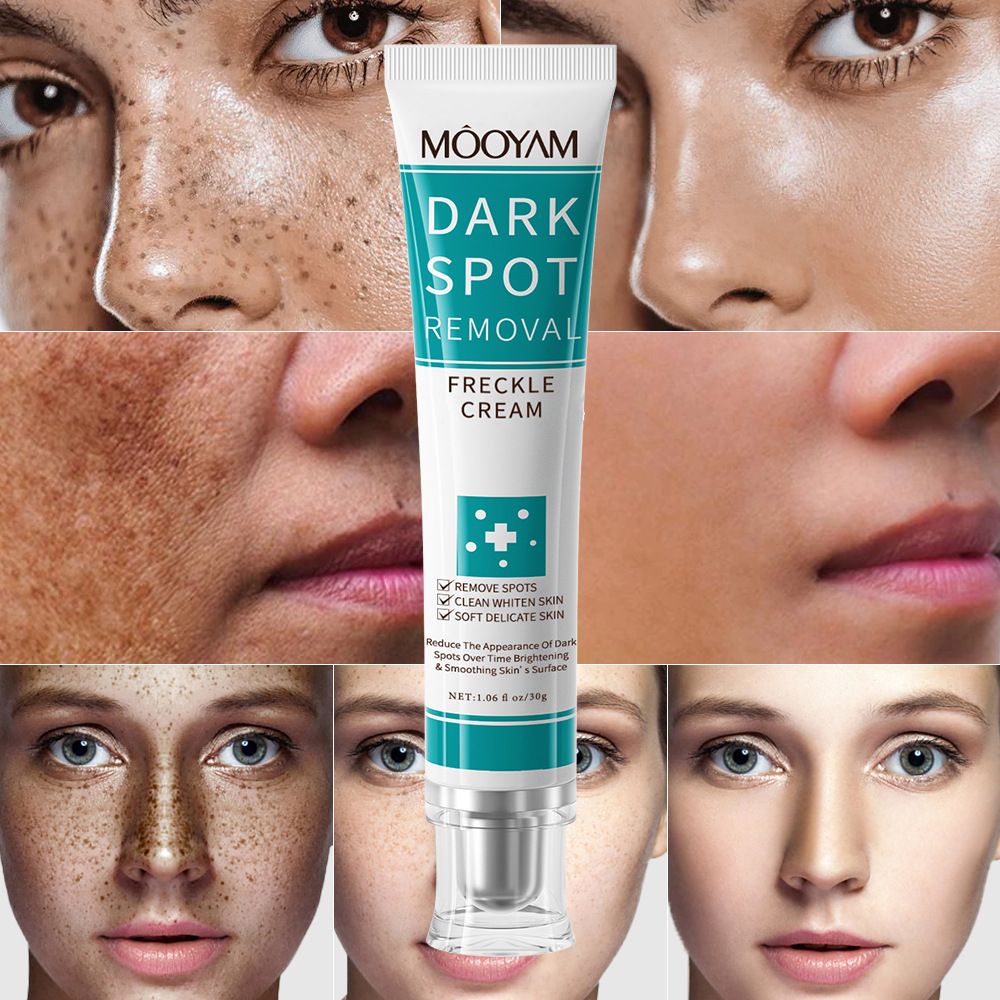 Lighten Fine Lines On Face, Moisturize Around Eyes, Firming, Brightening And Removing Freckles  Creams & Moisturizers