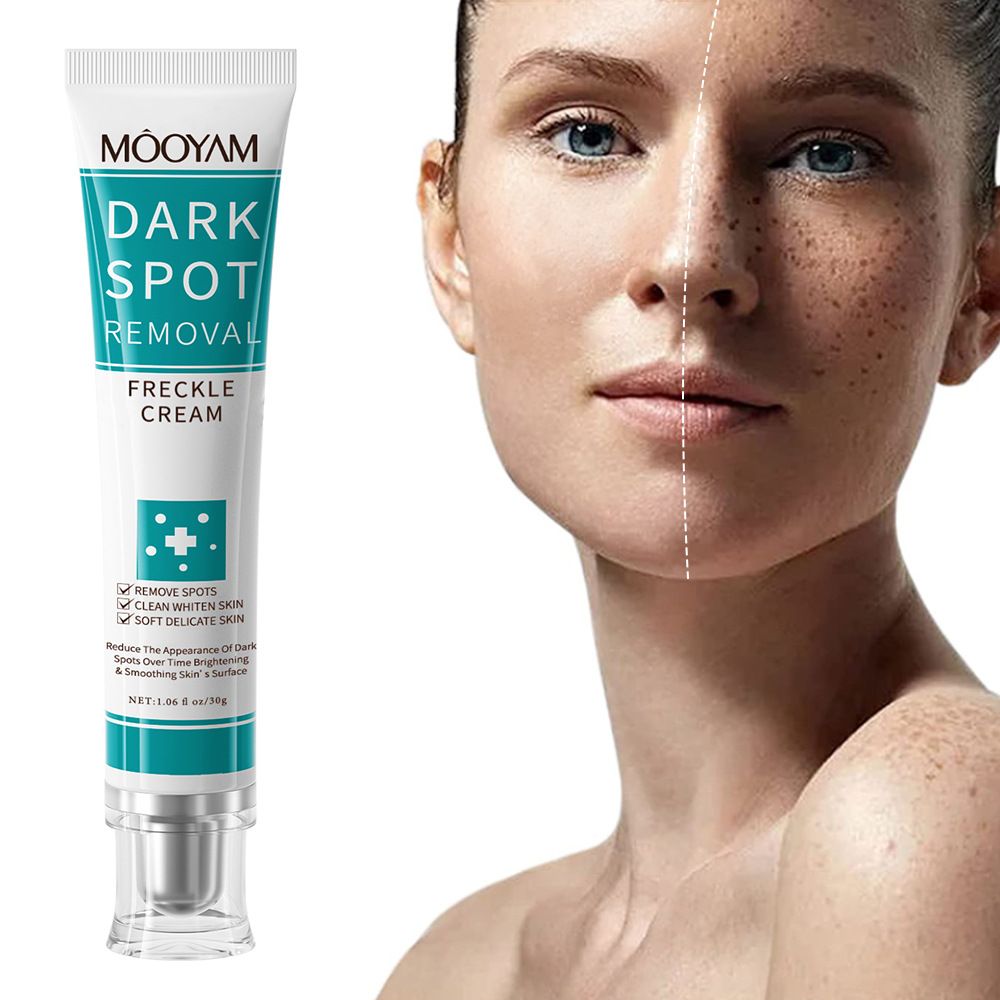 Lighten Fine Lines On Face, Moisturize Around Eyes, Firming, Brightening And Removing Freckles  Creams & Moisturizers