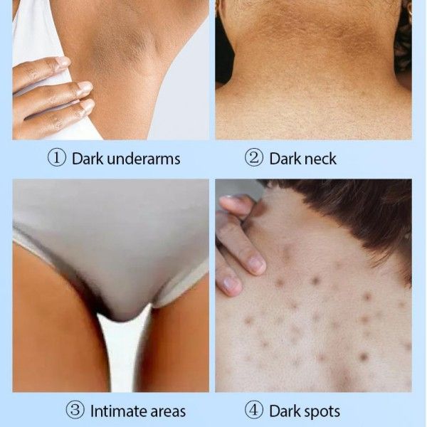 White Intimate Cream Brightening Skin Underarm Inner Thigh Brightening And Removing Black Cream  Body Butter