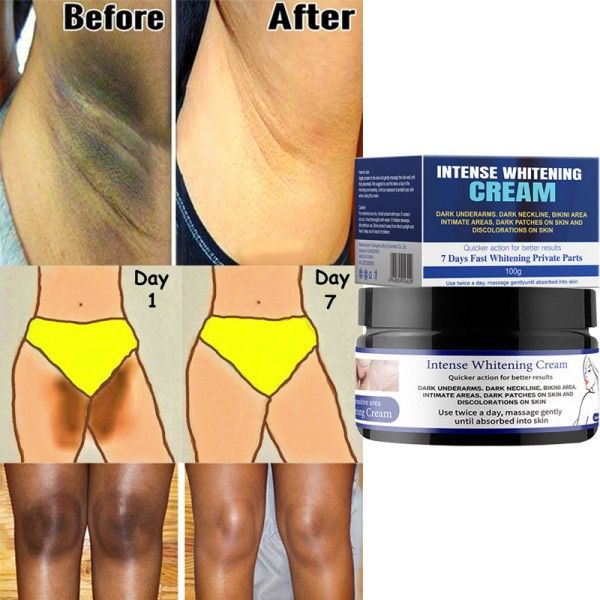White Intimate Cream Brightening Skin Underarm Inner Thigh Brightening And Removing Black Cream  Body Butter