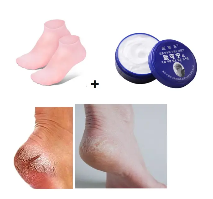foot care set foot mask moisturzing socks with foot cream set cracked heel repair kit foot spa kit gel socks& crackedheel cream set footcare bundle heel balm anti-crack foot cream dry feet treatment