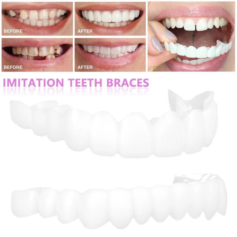 SXCHEN 2 Pairs Denture Care Tooth Whitening FakeTooth Jacket Simulation Braces Upper Teeth The Second Generation of The Teeth the Sixth Generation With Hole Simulation Braces Whitening Fake Braces Ora