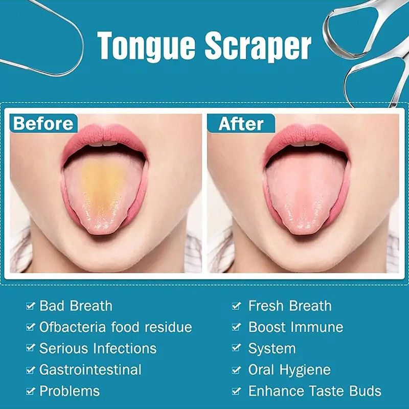 Oral Care Tongue Cleaners Stainless Steel Tongue Scraper Tongue Coating Cleaning Tongue Scraper Oral Cleaning Care Cleaning Tool Tongue Scraper