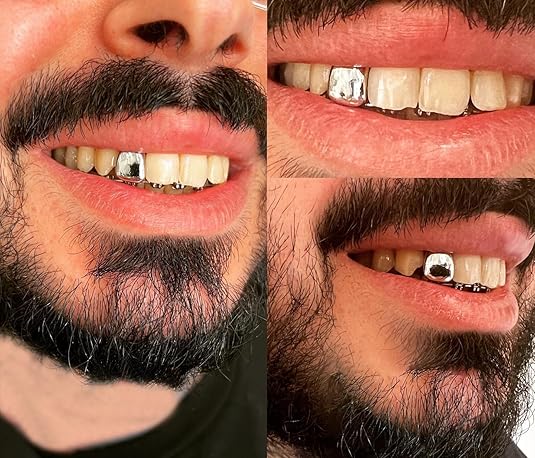 2 Pieces of （ Gold + Silver ) Single Tooth Couple Party Braces Popular Hip-Hop Hot Unisex Selling Popular Dental Braces Fashion Cool  Gold-Plated Teeth + Silver Braces