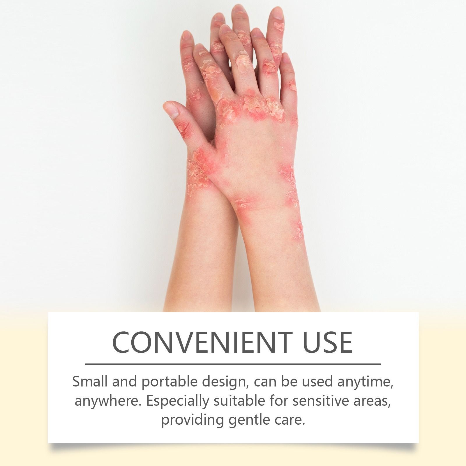 SOUTH MOON bee venom skin nursing cream gentle nourish skin dry discomfort body nursing cream