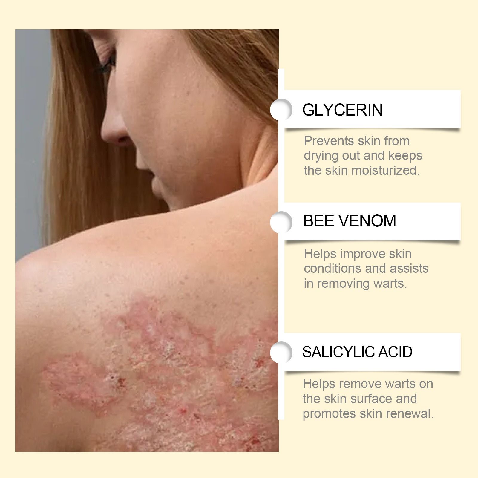 SOUTH MOON bee venom skin nursing cream gentle nourish skin dry discomfort body nursing cream